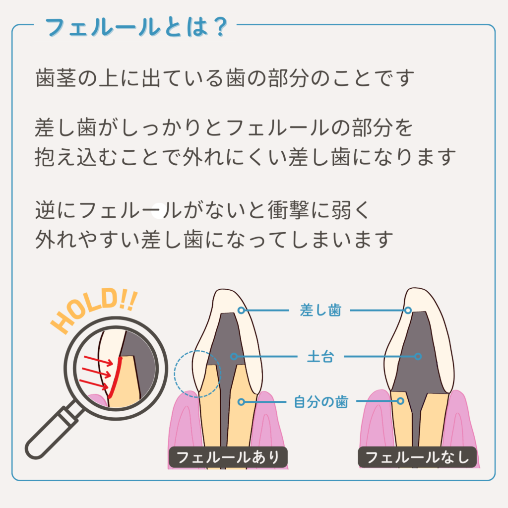 フェルールとは？
歯茎の上に出ている歯の部分のことです。差し歯がしっかりとフェルールの部分を抱え込むことで、取れにくい差し歯になります。
逆にフェルールがないと衝撃に弱く、取れやすい差し歯になってしまいます。